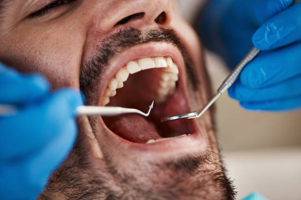 Best Emergency Tooth Extraction  in Glen Allen, VA