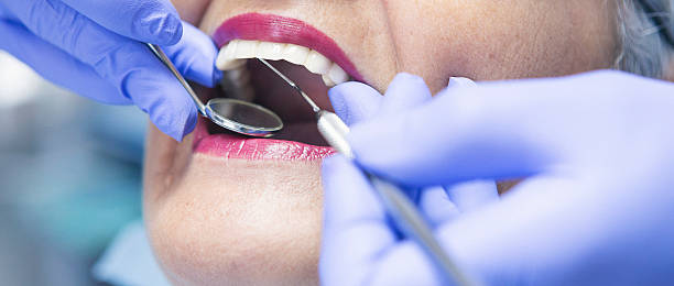 Best Dentist for Tooth Abscess  in Glen Allen, VA